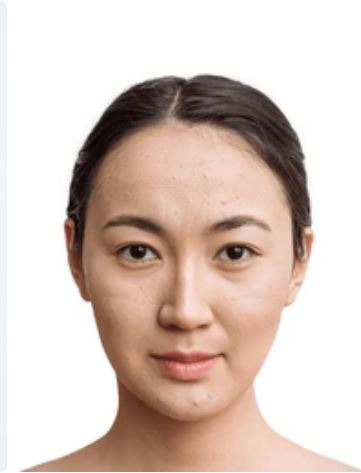 image comparison before