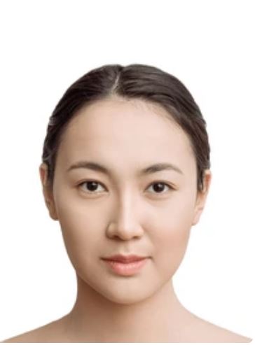 image comparison after