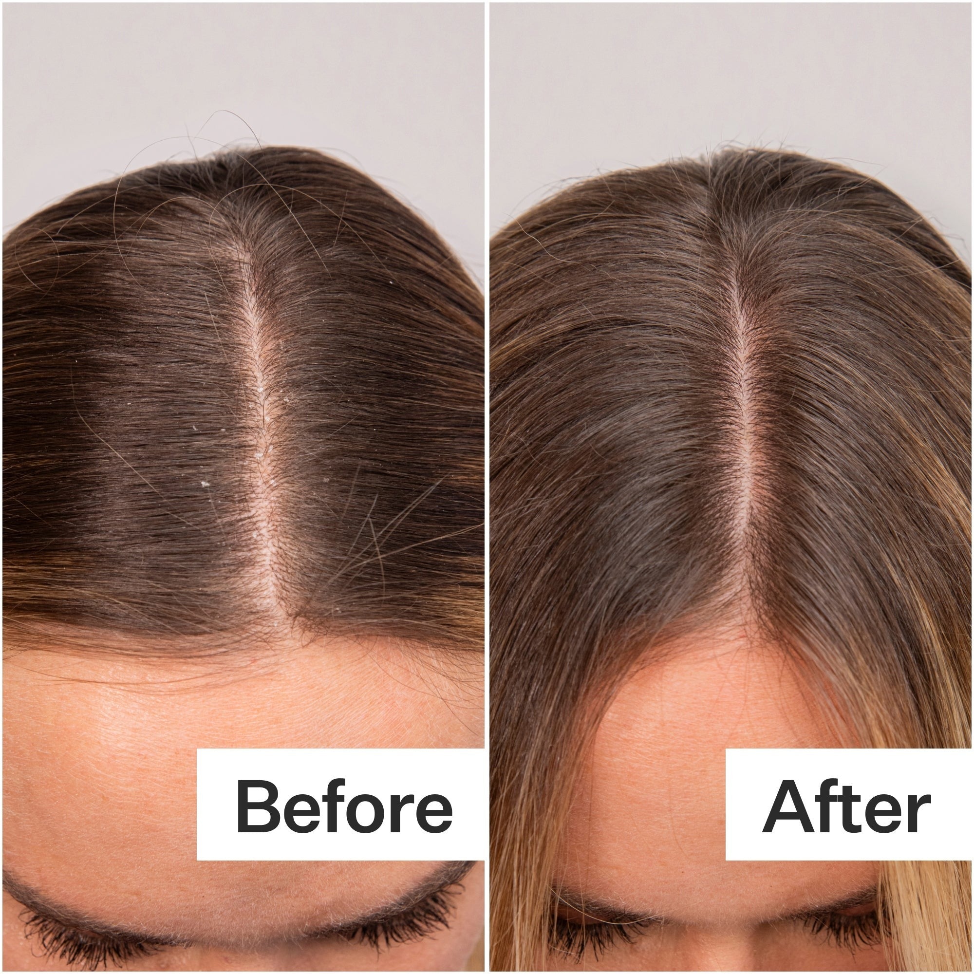 Act+Acre Daily Hydro Scalp Serum 30ml