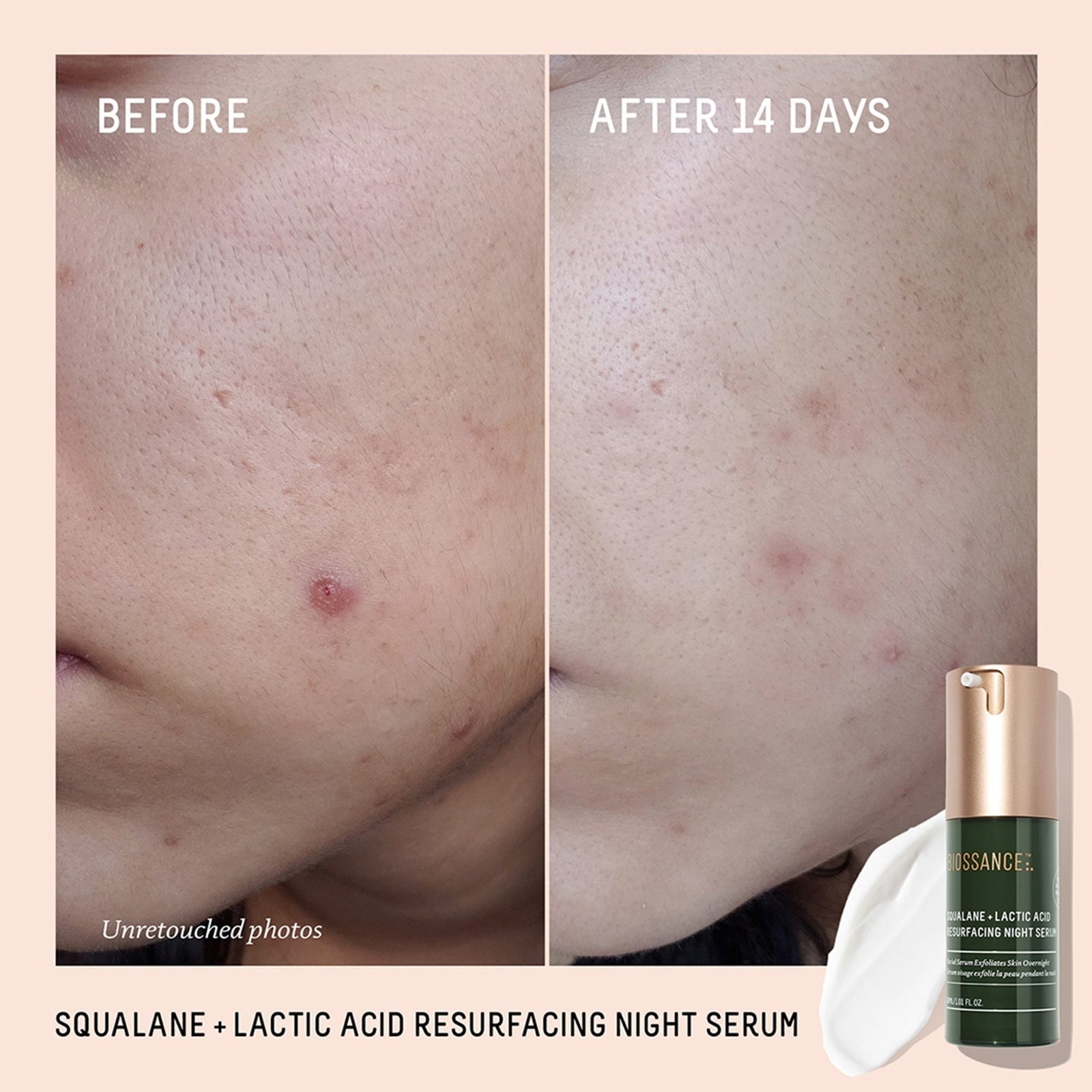 Biossance Squalane and Lactic Acid Resurfacing Serum 30ml