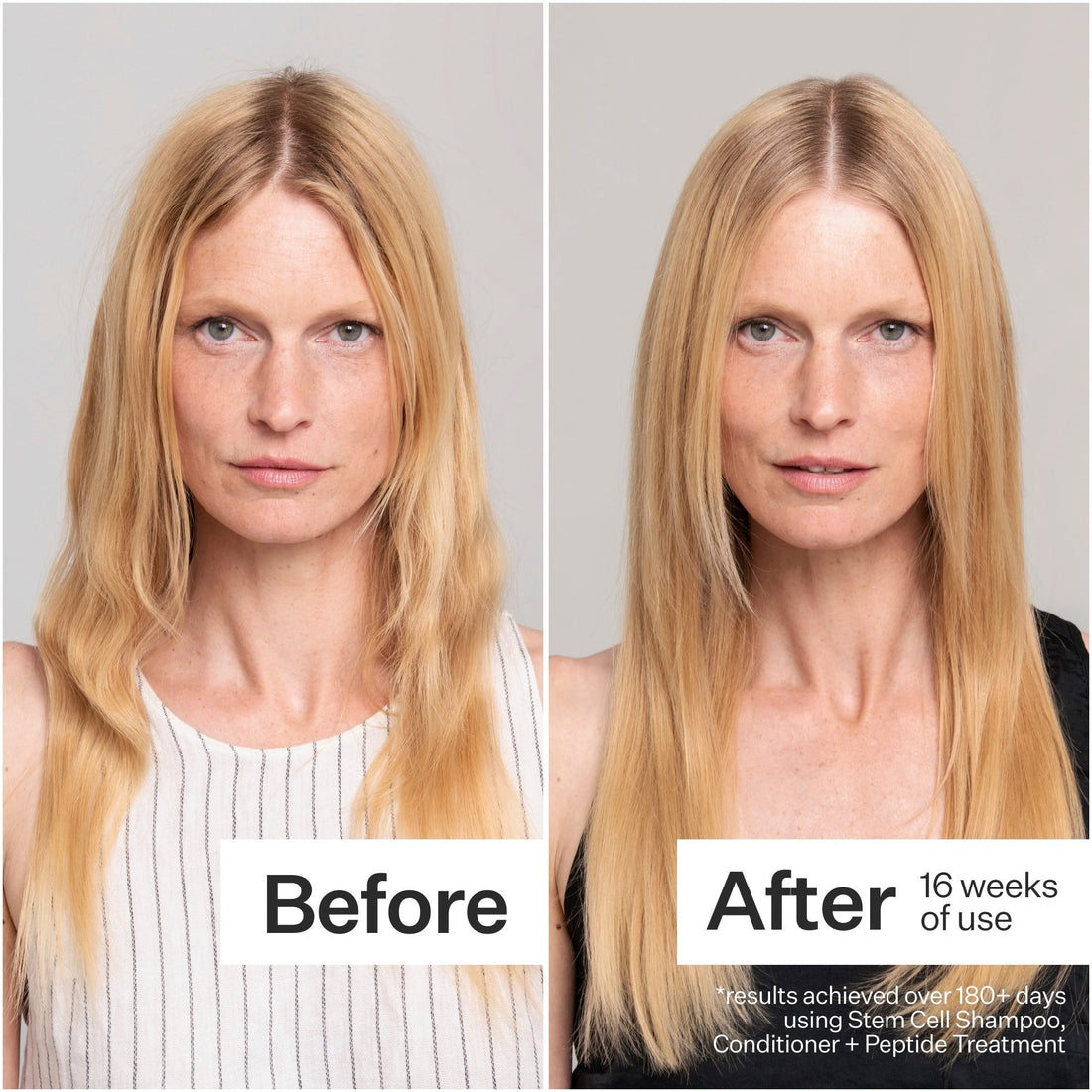 Act+Acre Stem Cell Conditioner for Hair Thinning and Growth 295ml