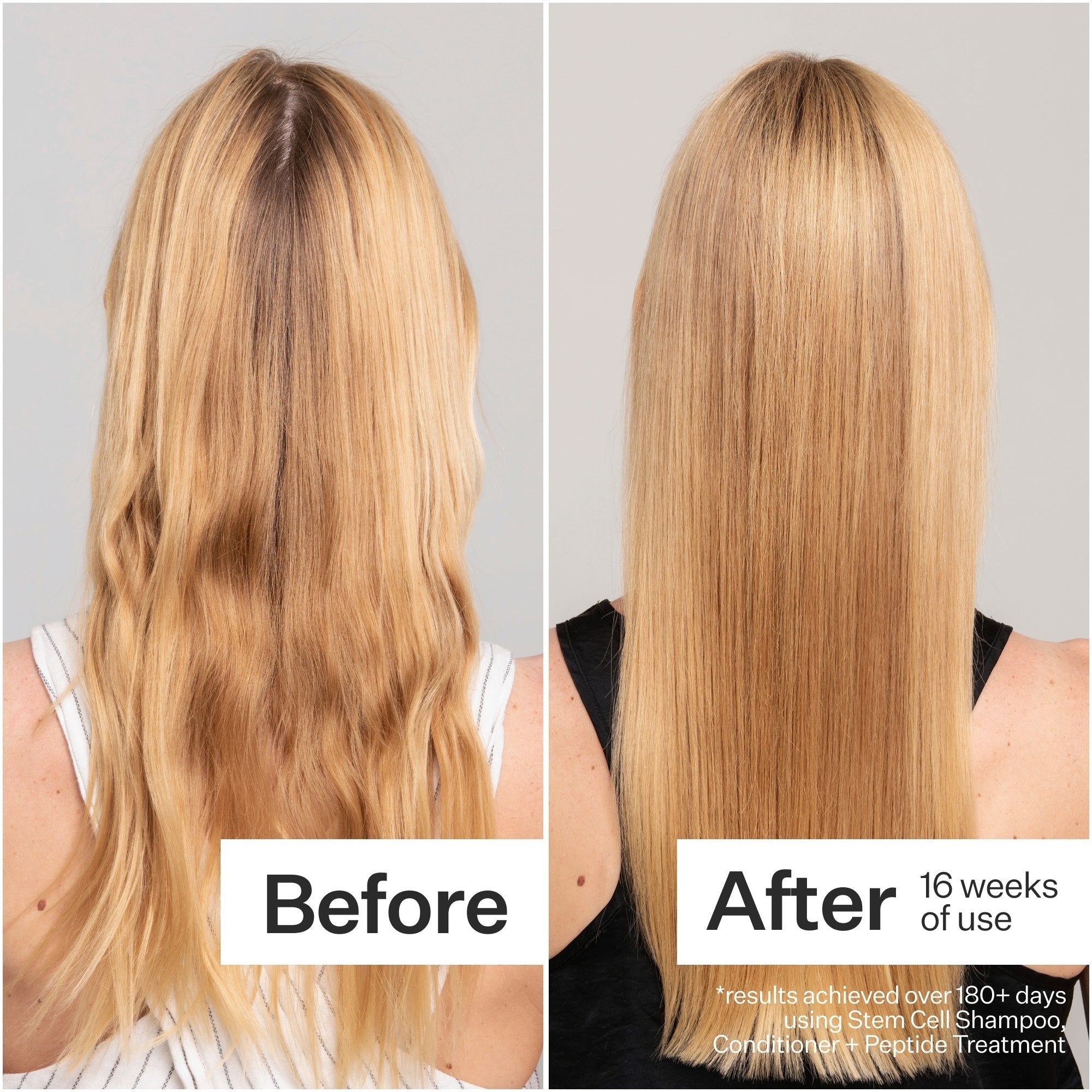 Act+Acre Stem Cell Conditioner for Hair Thinning and Growth 295ml