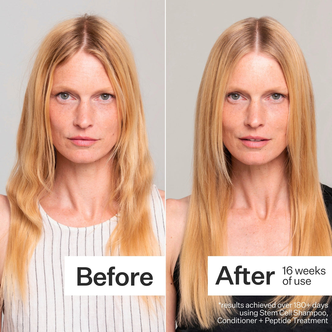 Act+Acre Stem Cell Shampoo for Hair Thinning and Growth 295ml