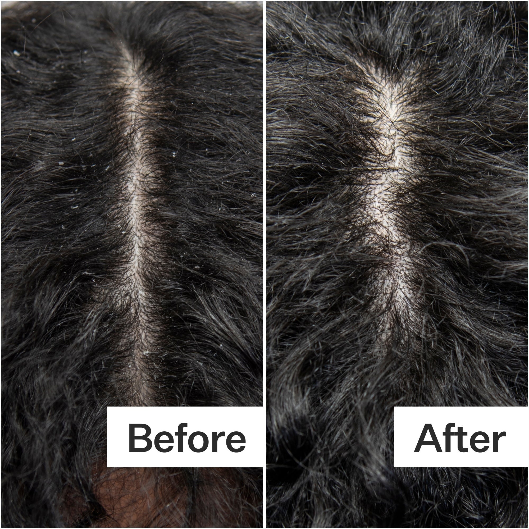 Act+Acre Cold Processed Scalp Detox 3.0 fl oz