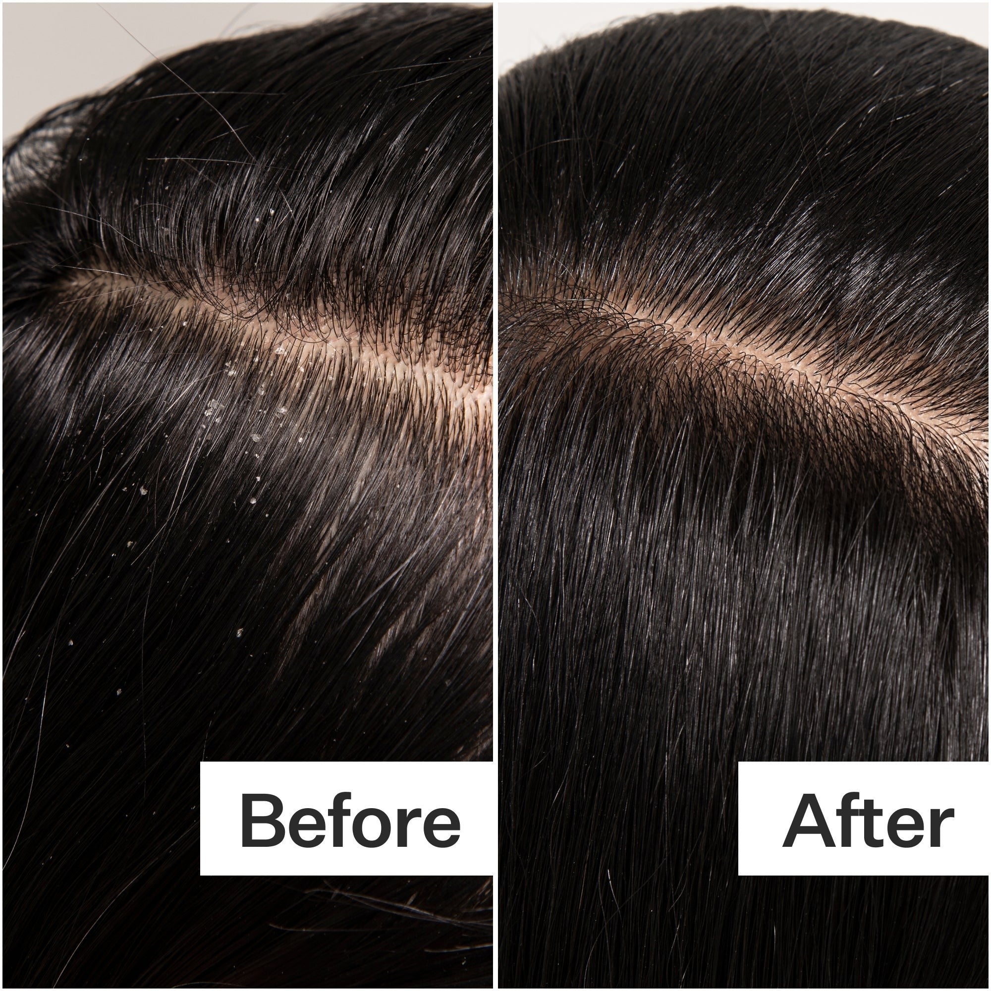 Act+Acre Cold Processed Scalp Detox 3.0 fl oz