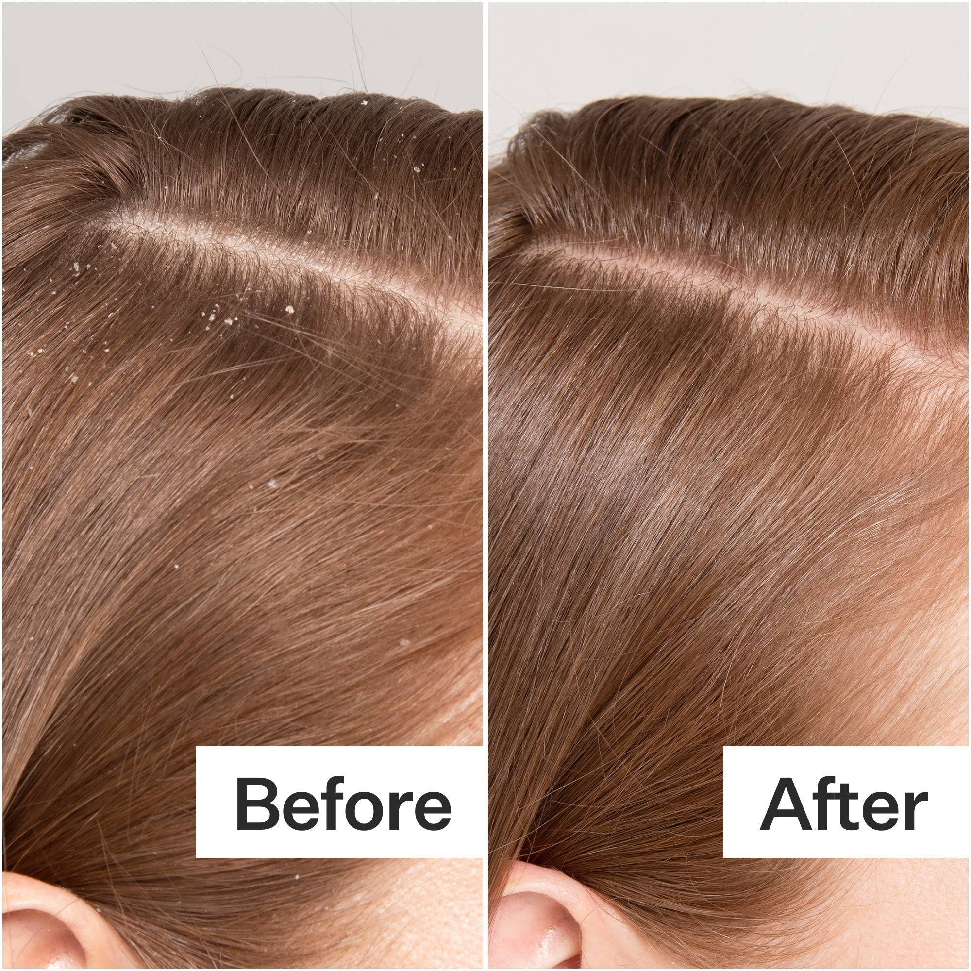 Act+Acre Cold Processed Scalp Detox 3.0 fl oz