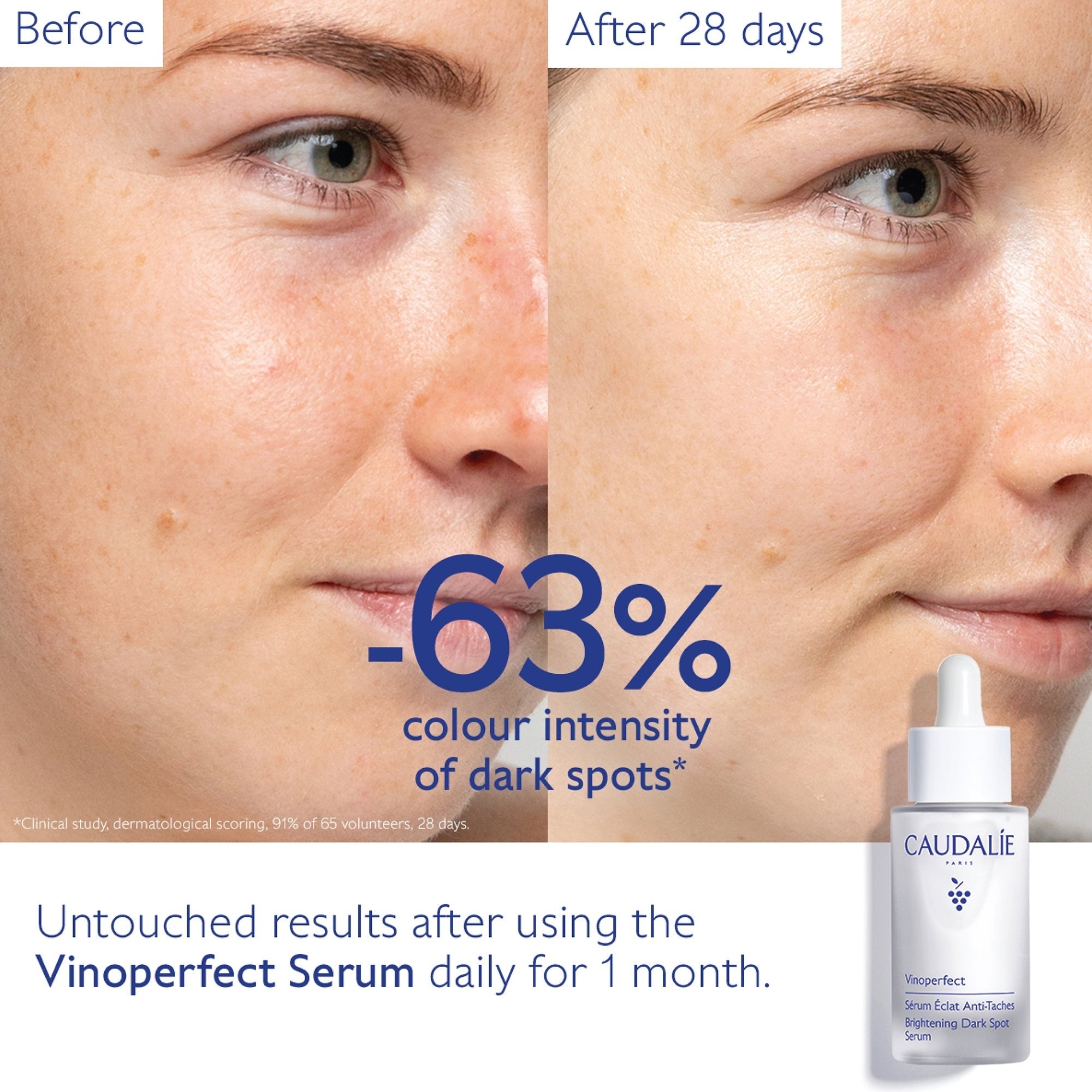 Caudalie Vinoperfect Brightening Dark Spot Serum 30ml
